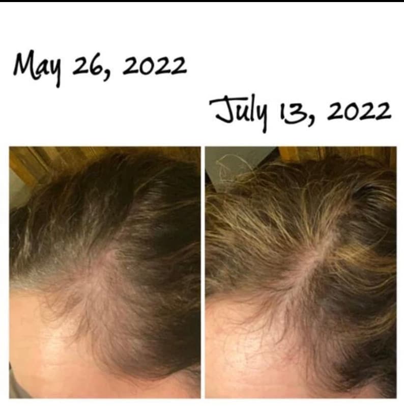 Superior Growth Grease, All Natural Hair Grease,aloe Vera Hair Grease