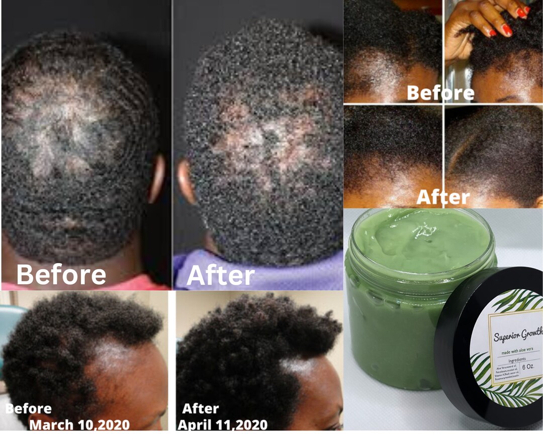Superior Growth Grease All Natural Hair Greasealoe Vera Hair - Etsy