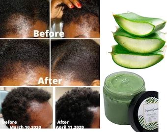Pomada capilar superior para crescimento, pomada capilar totalmente natural, pomada capilar com aloe vera, pomada para crescimento capilar, hidratante capilar, crescimento capilar, cabelos grossos