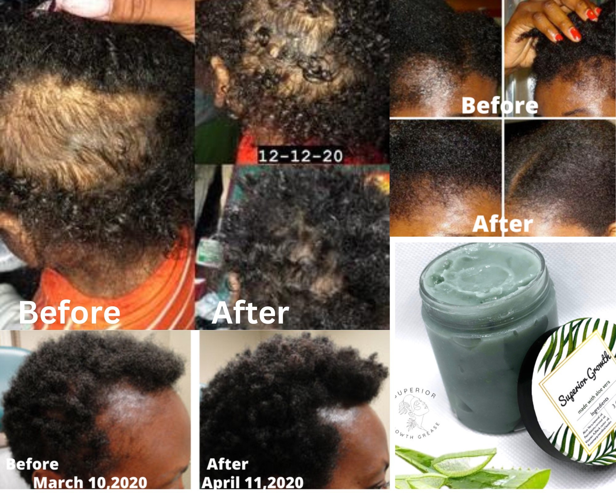 Hair Growth Aloe - Etsy Hair Growth Aloe - Etsy