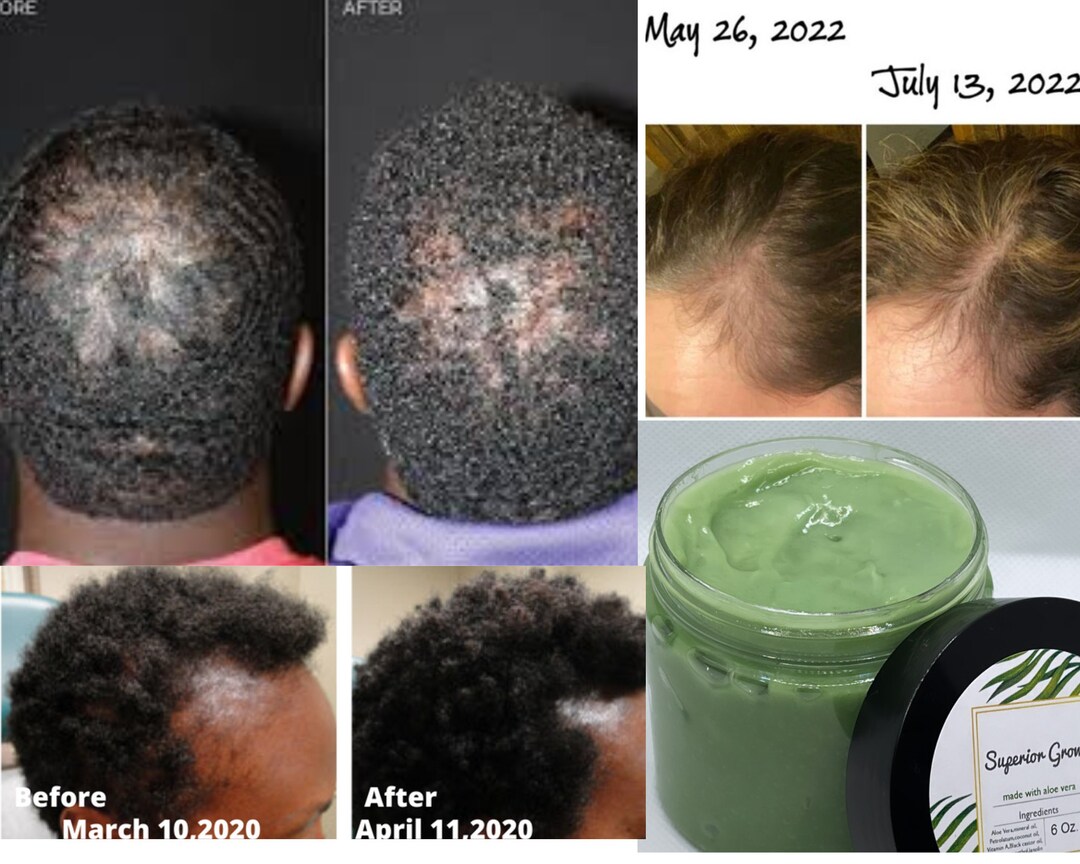 Superior Growth Grease, All Natural Hair Grease,aloe Vera Hair Grease