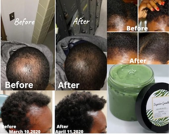 Grasa para el crecimiento superior, grasa capilar totalmente natural, grasa capilar con aloe vera, grasa para el crecimiento del cabello, humectante para el cabello, crecimiento del cabello, cabello grueso