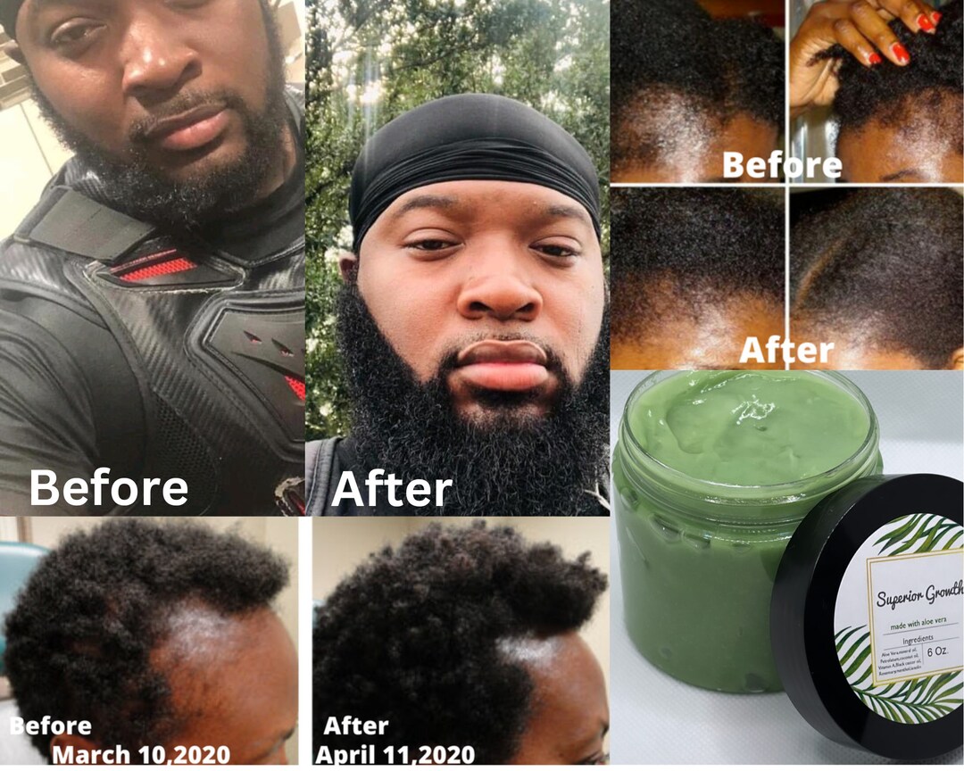 Superior Growth Grease, All Natural Hair Grease,aloe Vera Hair Grease