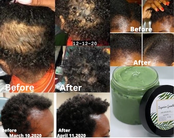 Grasa para el crecimiento superior, grasa capilar totalmente natural, grasa capilar con aloe vera, grasa para el crecimiento del cabello, humectante para el cabello, crecimiento del cabello, cabello grueso