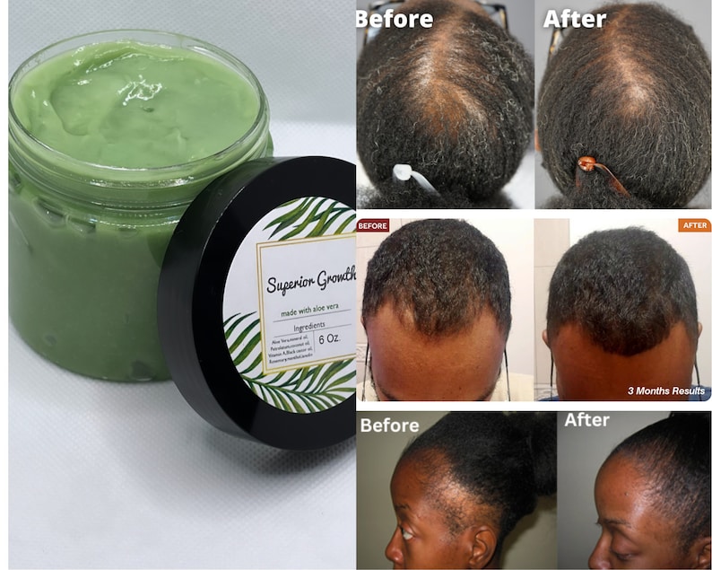 Superior Growth Grease, All Natural Hair Grease,aloe Vera Hair Grease