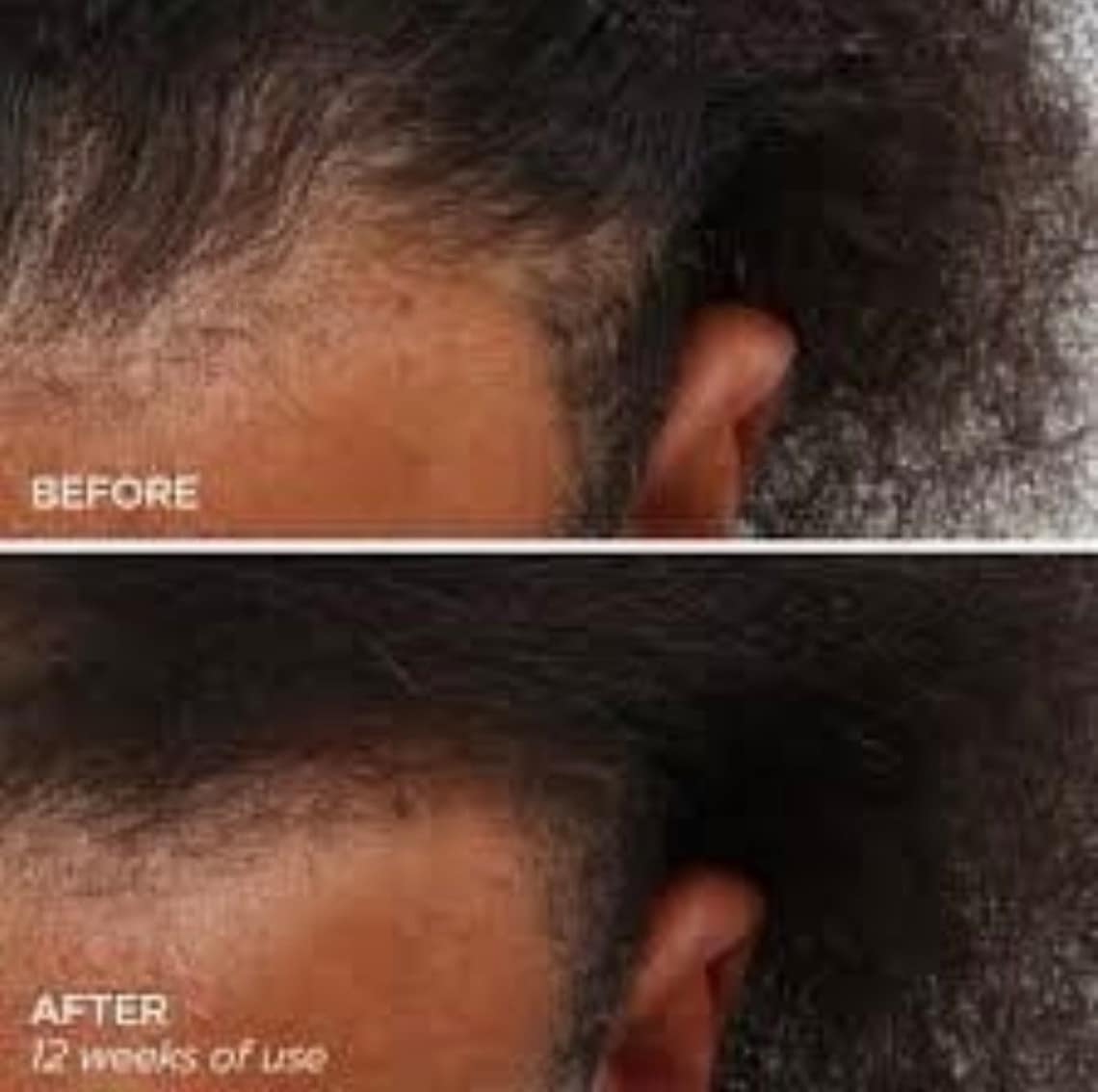 Superior Growth Grease, All Natural Hair Grease,aloe Vera Hair Grease