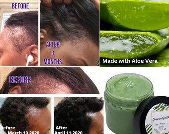 Grasa para el crecimiento superior, grasa capilar totalmente natural, grasa capilar con aloe vera, grasa para el crecimiento del cabello, humectante para el cabello, crecimiento del cabello, cabello grueso