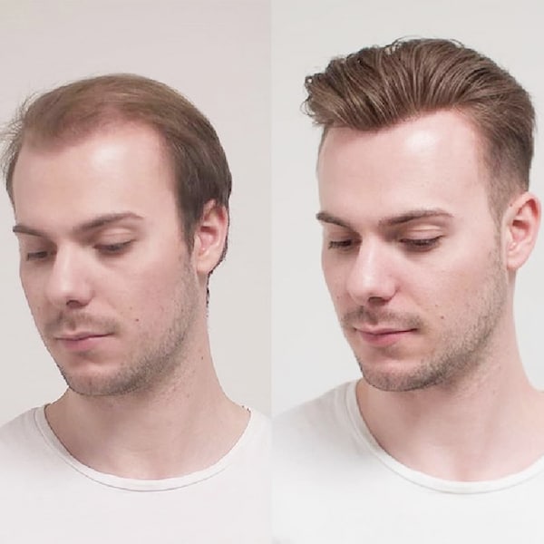 100% Human Hair Toupee for Men-Full Thin Skin PU Base-Swiss lace-Hand tied lace-Natural hairline-hairpieces for men-BIO-hair replacement