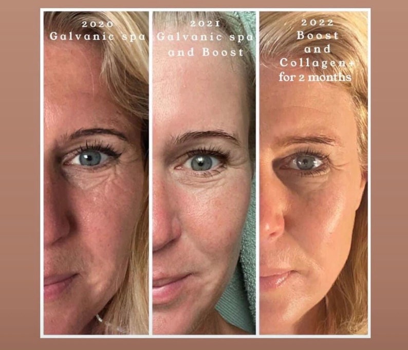 KIT Ageloc Galvanic Spa Facial Gels for Antiaging Device 1 Etsy