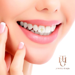 May include: Close-up of a person's smile with a gold tooth grill featuring a star design. The grill is on the front teeth. The person is wearing pink lipstick and has a white background.