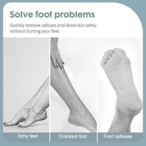 Pedicure Foot SPA Set Callus Shaver Scraper Tool Professional Manicure  ,Solve Various Foot Problems Premium Nail