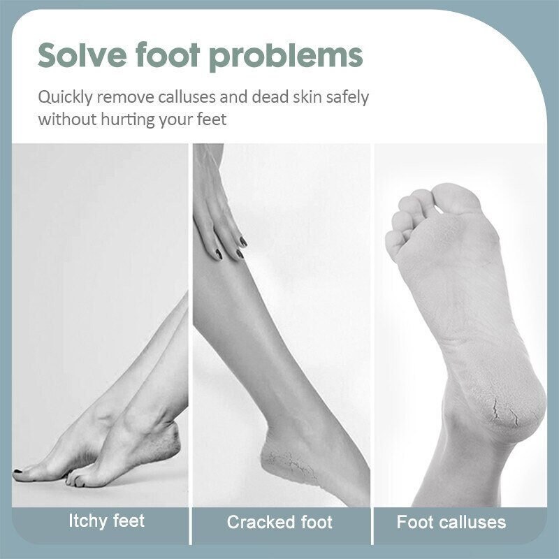 Best tool for removing dead skin shop from feet