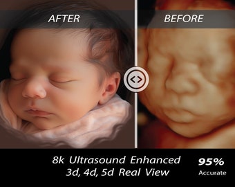 3D, 4D, 5D en HD Echografie, echografie baby, Real View, echografie foto, nieuwe moeder, kraamcadeau, ongeboren baby, echografie