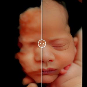 Real View Ultrasound Photo