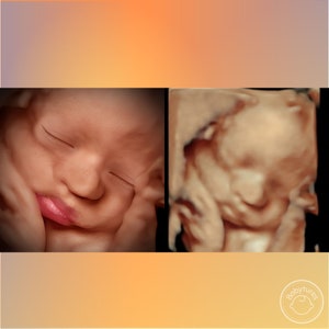 8K ultrasound Turn 3D/5D/HD ultrasounds into an 8K image image 9