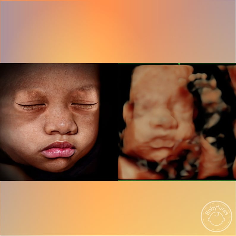 8K ultrasound Turn 3D/5D/HD ultrasounds into an 8K image image 6