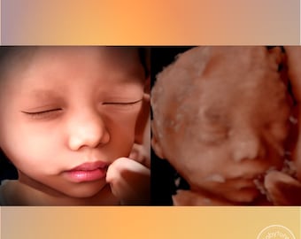 8K ultrasound | Turn 3D/5D/HD ultrasounds into an 8K image