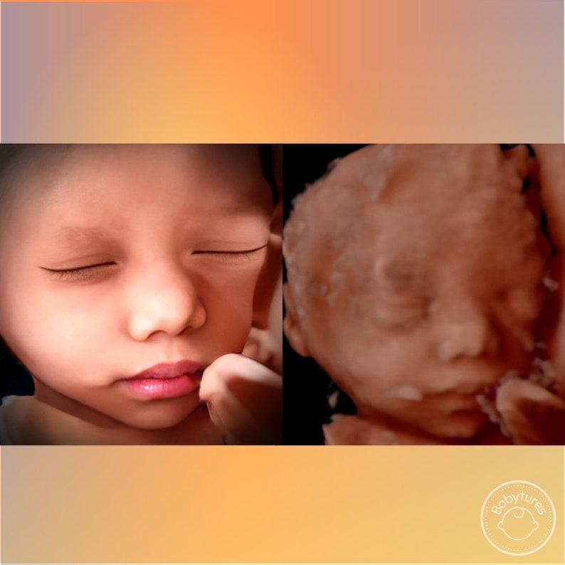 8K ultrasound Turn 3D/5D/HD ultrasounds into an 8K image image 1