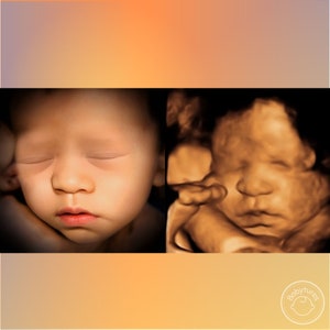 8K ultrasound Turn 3D/5D/HD ultrasounds into an 8K image image 8