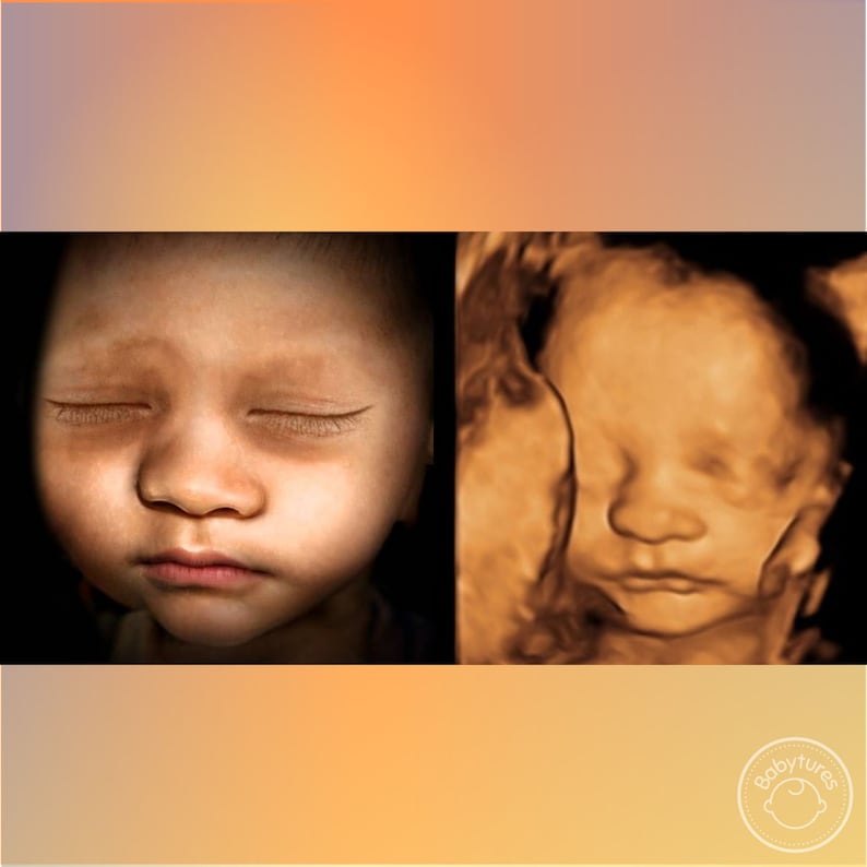 8K ultrasound Turn 3D/5D/HD ultrasounds into an 8K image image 2