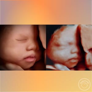 8K ultrasound Turn 3D/5D/HD ultrasounds into an 8K image image 4