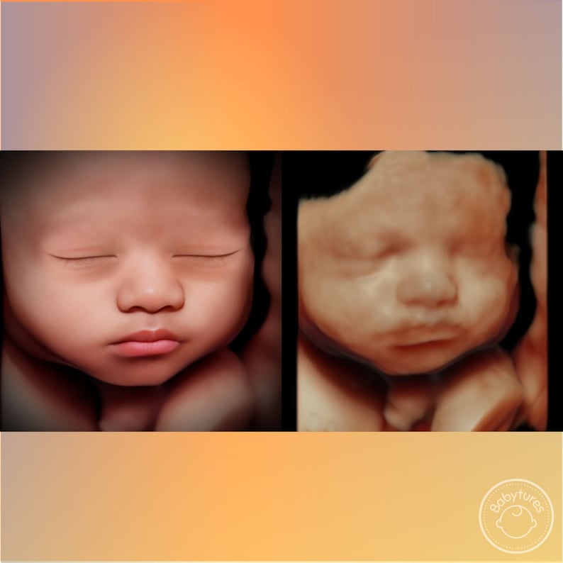 8K ultrasound Turn 3D/5D/HD ultrasounds into an 8K image image 3