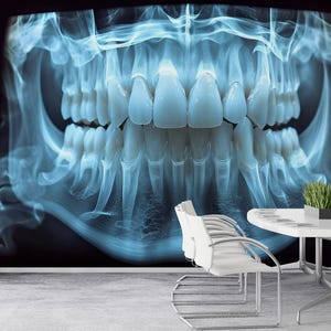 Op de afbeelding: Een röntgenfoto van een menselijke kaak en tanden, in blauwe en witte tinten. De afbeelding wordt op een muur weergegeven, met een witte tafel en stoelen ervoor. Een kleine plant in een zwarte pot staat op de tafel.