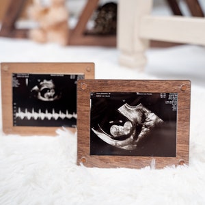 May include: Two wooden picture frames with ultrasound images. The frames are square with a dark wood finish and small metal accents. The images show a baby's sonogram, capturing a moment in time.