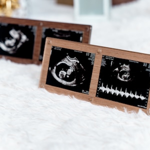 May include: Three wooden frames with black and white ultrasound images of a baby. The frames are on a white fluffy surface.