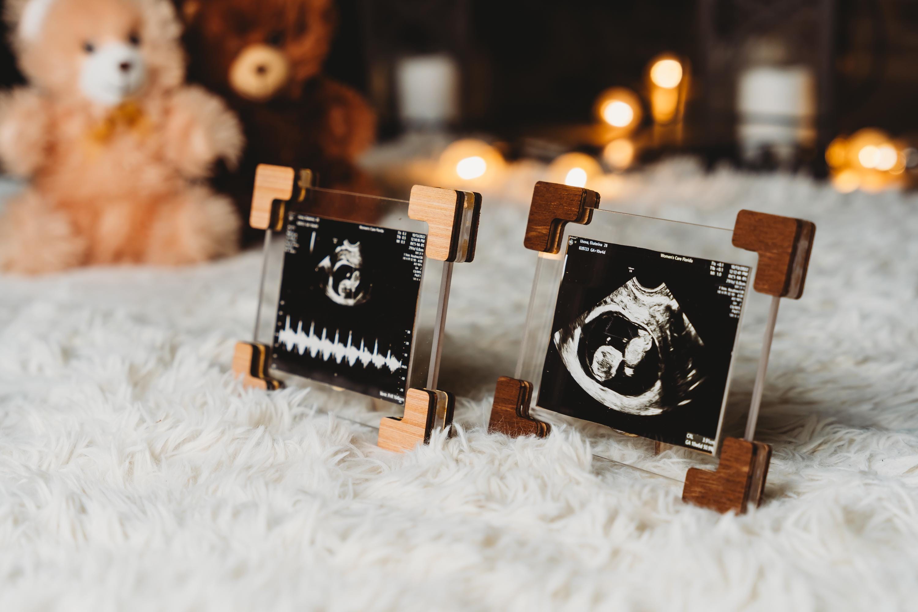 Ultrasound Picture Frame Sonogram Frame Transparent Clear Baby Announcement First Ultrasound Heartbeat