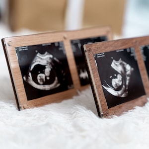 May include: Several ultrasound images displayed in wooden frames. The black and white sonograms show developing fetuses. The frames have a light wood grain appearance and are displayed on a white, fluffy surface.