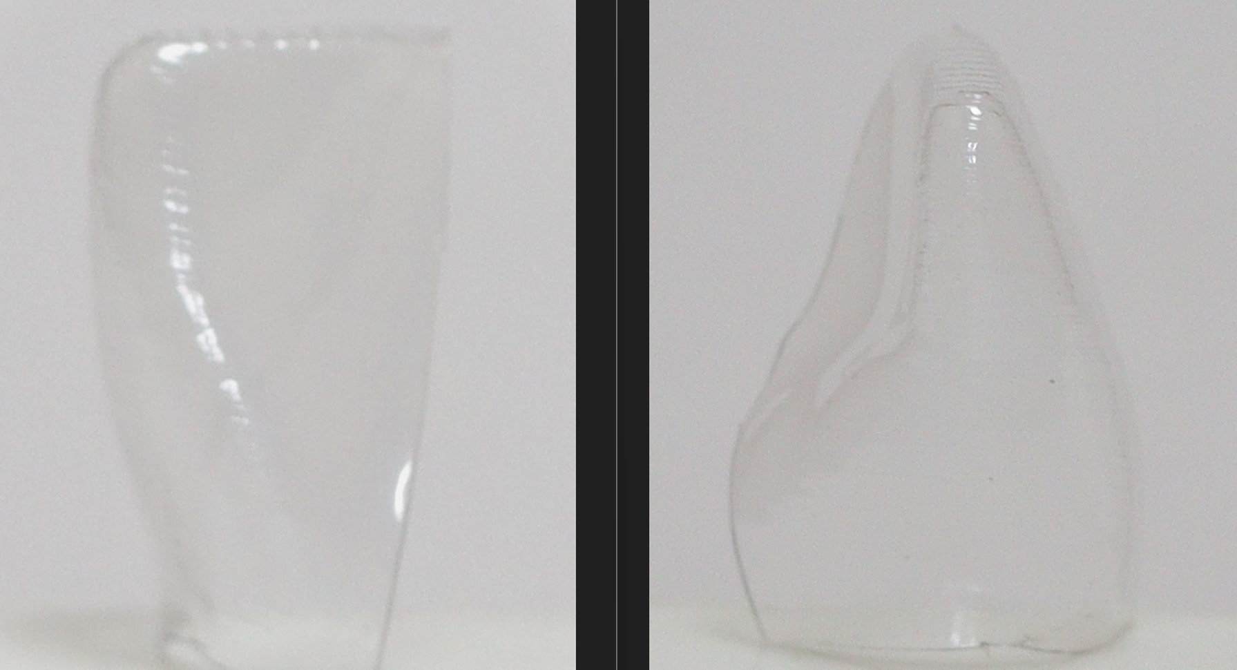 Superior Anatomical Clear Matrix Maxillary Anterior Teeth Etsy