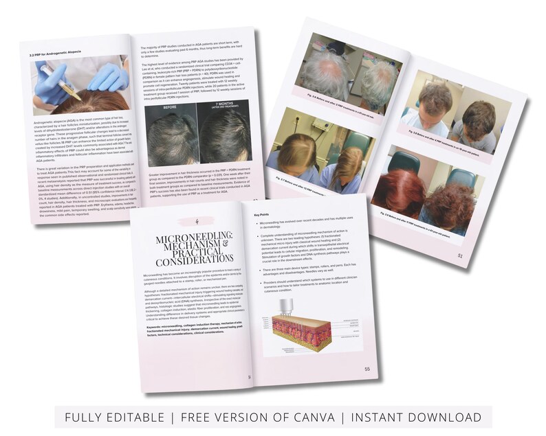 PRP & Microneedling Training Manual, Platelet Rich Plasma, Skin Needling, Skin Care, Scalp, Hair, Guide, Online Course, Edit in Canva