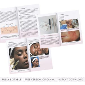 PRP & Microneedling Training Manual, Platelet Rich Plasma, Skin Needling, Skin Care, Scalp, Hair, Guide, Online Course, Edit in Canva