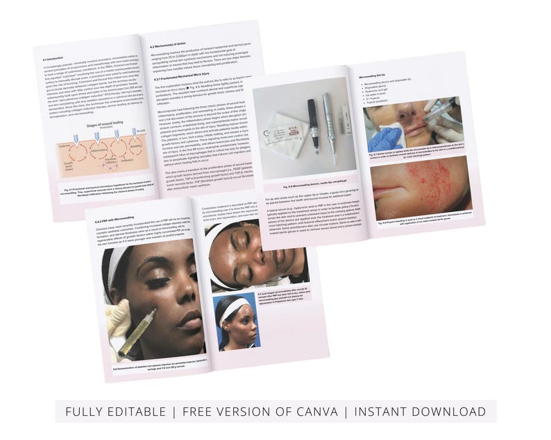 PRP & Microneedling Training Manual, Platelet Rich Plasma, Skin Needling, Skin Care, Scalp, Hair, Guide, Online Course, Edit in Canva