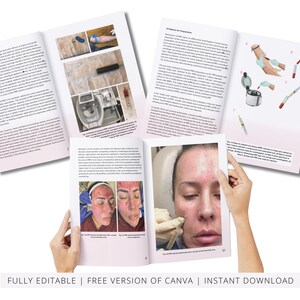 PRP & Microneedling Training Manual, Platelet Rich Plasma, Skin Needling, Skin Care, Scalp, Hair, Guide, Online Course, Edit in Canva