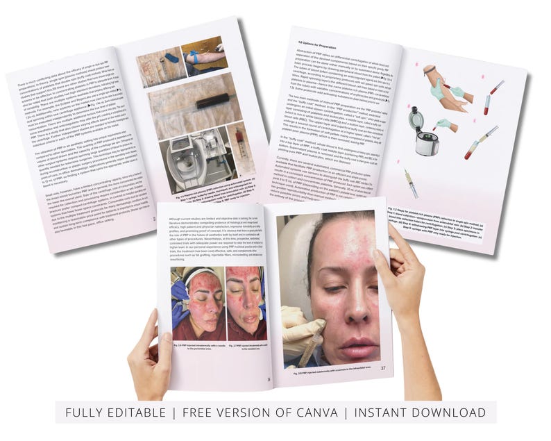 PRP & Microneedling Training Manual, Platelet Rich Plasma, Skin Needling, Skin Care, Scalp, Hair, Guide, Online Course, Edit in Canva