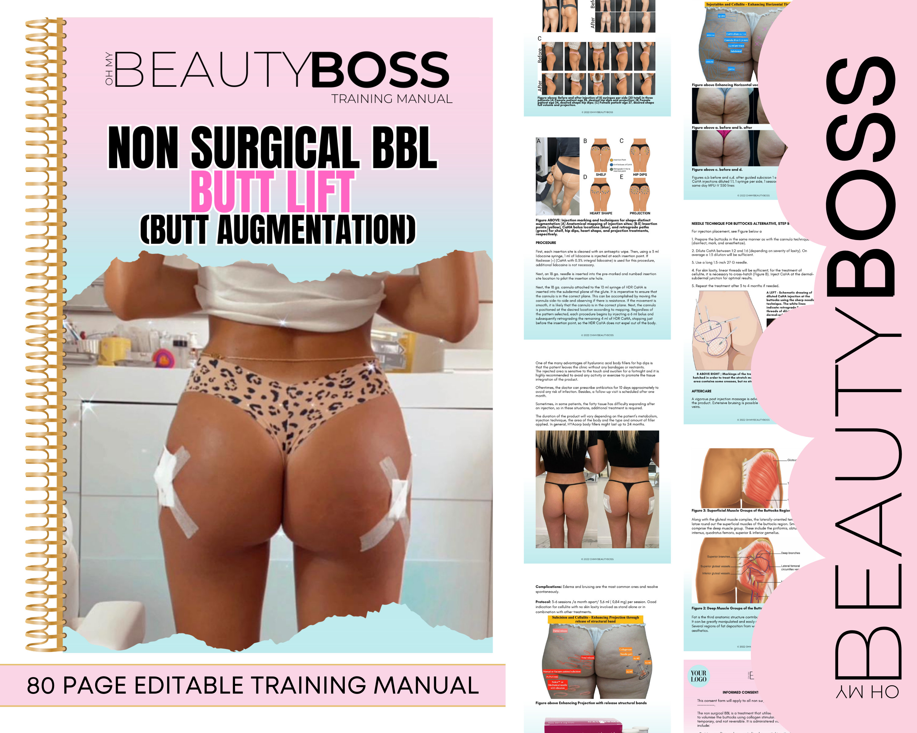 BBL BUTT LIFT, Butt Augmentation Training Manual, Non Surgical Buttock  Lift, Hip Dip Injections, Bum Filler Training Guide, Edit in Canva