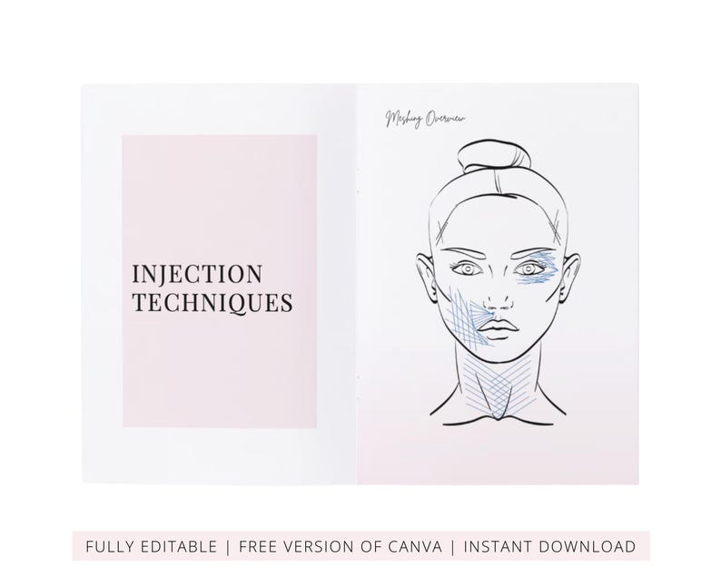 PDO & PLLA Threads Lifts Training Manual, Aesthetics Threads Mapping for Face, Neck, Body, Medical Student Guide, Edit in Canva