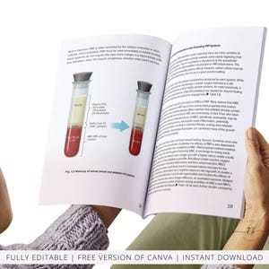 PRP & Microneedling Training Manual, Platelet Rich Plasma, Skin Needling, Skin Care, Scalp, Hair, Guide, Online Course, Edit in Canva