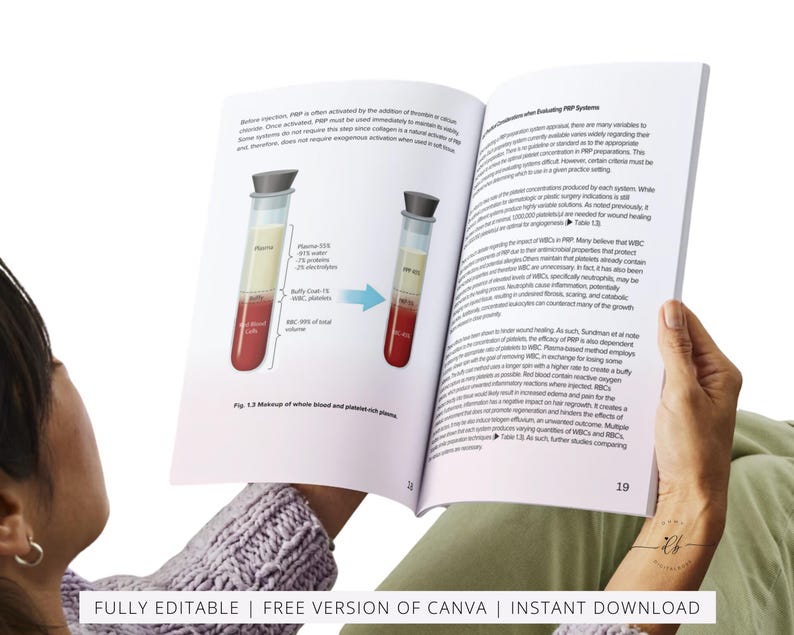 PRP & Microneedling Training Manual, Platelet Rich Plasma, Skin Needling, Skin Care, Scalp, Hair, Guide, Online Course, Edit in Canva