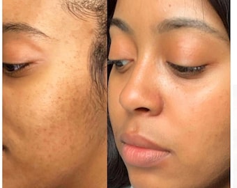 Jabón de ácido kójico, limón y cúrcuma con 2 % de kójico añadido