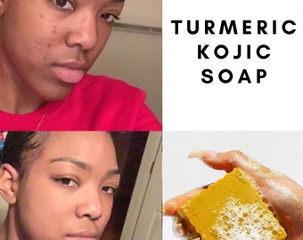 Tumeric Kojic Soap, Spots Remover, Even Skin Tone,Spotless Skin,Tumeric Soap, Acne Soap, Flawless Skin