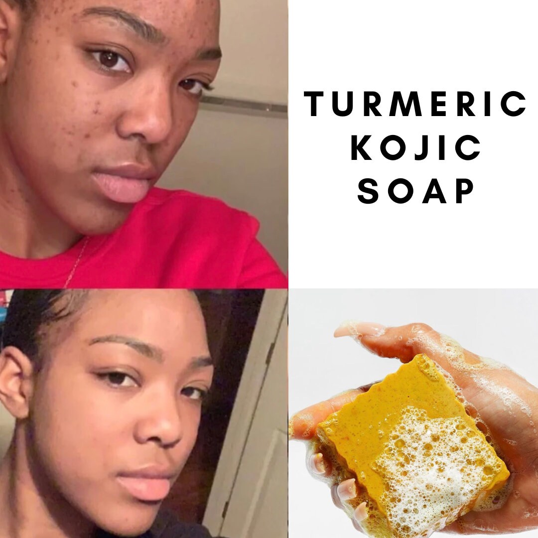 Turmeric & Kojic Brightening Soap, Dark Spots, Dark Inner Thighs, Acne