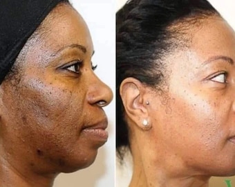 Jabón kójico de limón y cúrcuma: jabón de aceite esencial hecho a mano