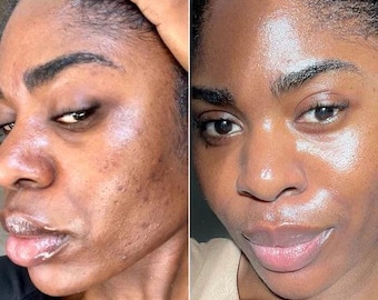 Handmade Turmeric Kojic Acid Soap, Goats Milk Soap, Lemon Oil, Brightening, 3.5 oz