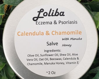 Double infused Calendula and Chamomile Salve, Eczema, Psoriasis, Oat Oil, dry Skin, Manuka Honey, Shea Butter, Skin Moisturizer & soother