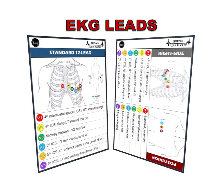 12 Lead Ecg Placement Diagram 1024x811