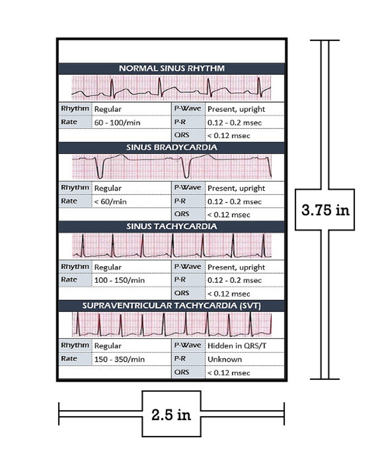 EKG Interpretation Digital Download Badge Buddy - Etsy