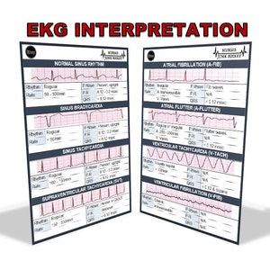 Badge Buddy - EKG Interpretation